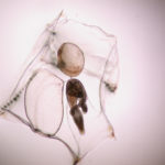 Les picors a les platges de Tamariu i Llafranc les causa la ‘Muggiaea atlantica’