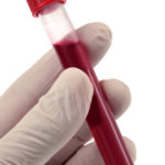 200 persones del Baix Empordà han estat escollides per formar part de l’estudi estatal de prevalença del COVID-19