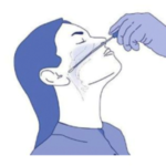 Al Baix Empordà, 70 casos positius per 3000 habitants a l’estiu