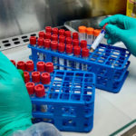 El risc de rebrot es redueix a la meitat en l’última setmana al Baix Empordà Laboratori de l'Hospital de Palamós amb proves PCR del coronavirus COVID-19 | Imatge del SSIBE