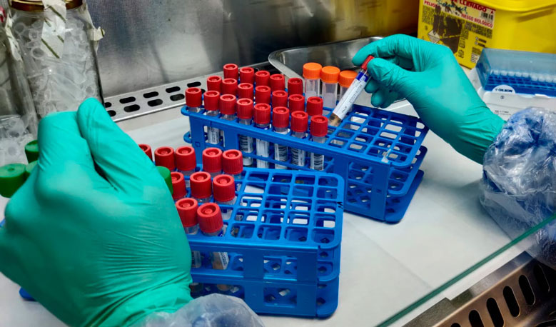 Laboratori de l'Hospital de Palamós amb proves PCR del coronavirus COVID-19 | Imatge del SSIBE