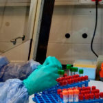 La nova unitat de biologia molecular de Palamós permet ampliar la detecció d’infeccions de transmissió sexual