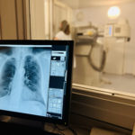 L’Hospital de Palamós incorpora la intel·ligència artificial en les seves exploracions radiològiques Proves radiològiques IA Palamós